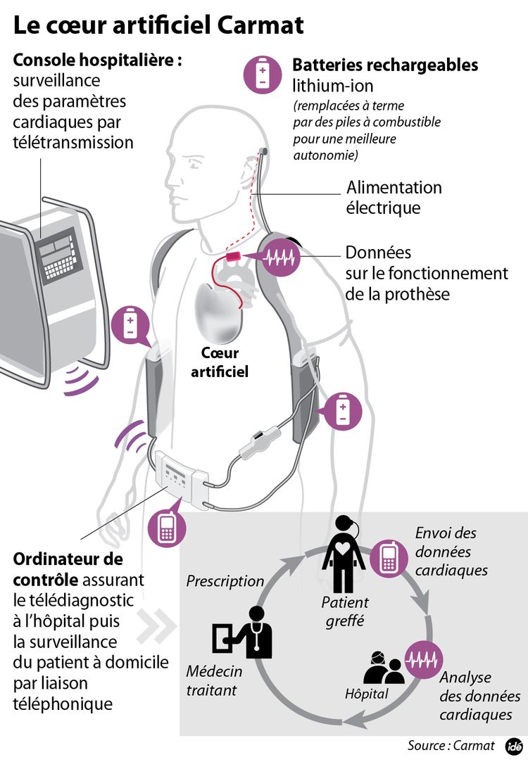 606389-ide-coeur-carmat-systeme